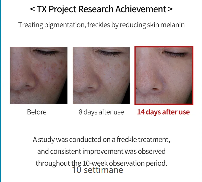 Crema per melasma e macchie Dr. Melaxin TX Cream
