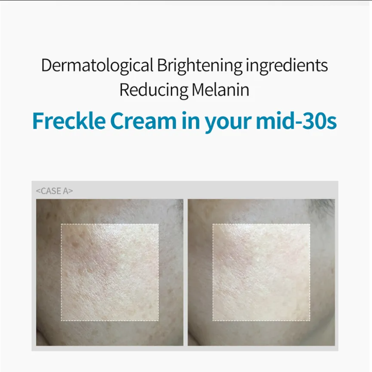 Siero per melasma e macchie Dr. Melaxin