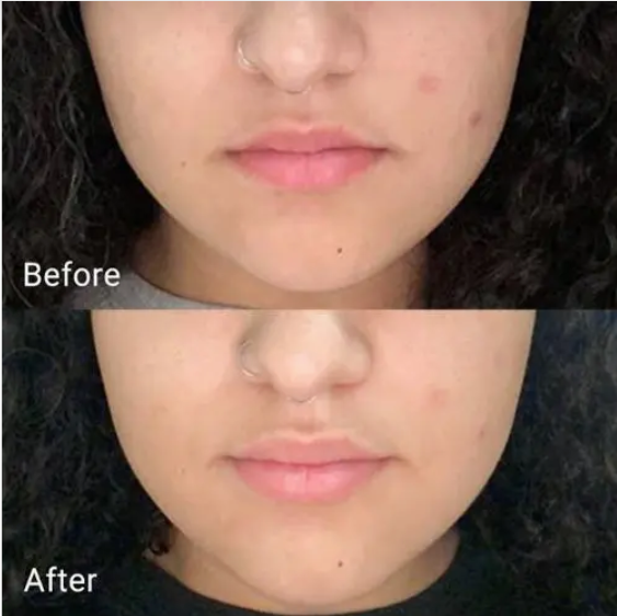 Maschera Peel-Off Delicata per  Pelle Radiosa e Pulita
