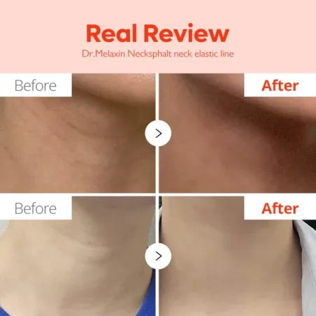 crema per rassodare collo Necksphalt ECM Neck Barrier Cream – 50ml DR.MELAXIN
