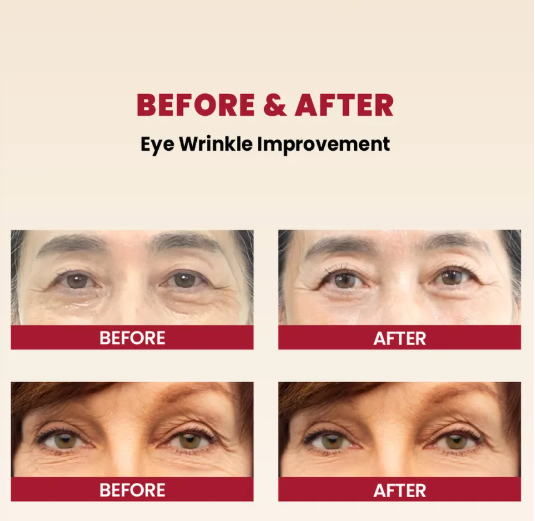 KSECRET Crema occhi  retinal e fermenti di legumi Eye Cream : Retinal Liposome 4% + Fermented Bean