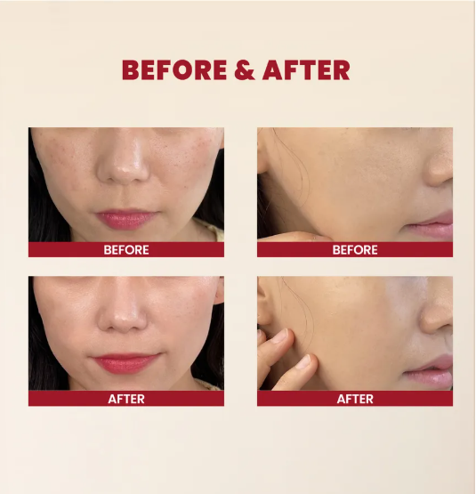 KSECRET Essenza 97% bava di lumaca e riso Essence : Snail Mucin 97% + Rice 100ml