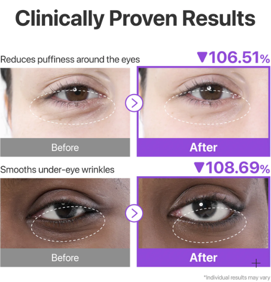 Numbuzin – No.9 NAD+ Eye Patches, 1 coppie