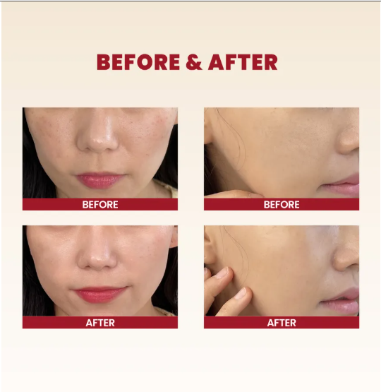 KSECRET Crema con il 93% di bava di lumaca e estratto di riso. Cream : Snail Mucin 93% + Rice 100ml