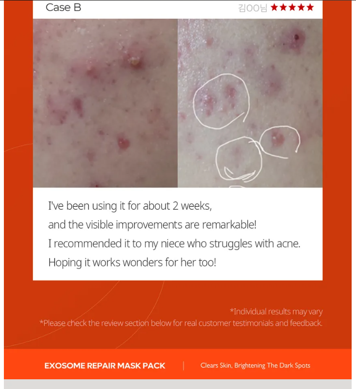 Exosome Repair Mask 5 pz Dr.Melaxin